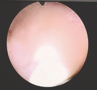 5´ŮӤ˫ʯ 20Сʱ ǰιʳǵĻ